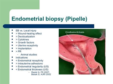 Endometrial biopsy: Procedure, recovery, results, and .